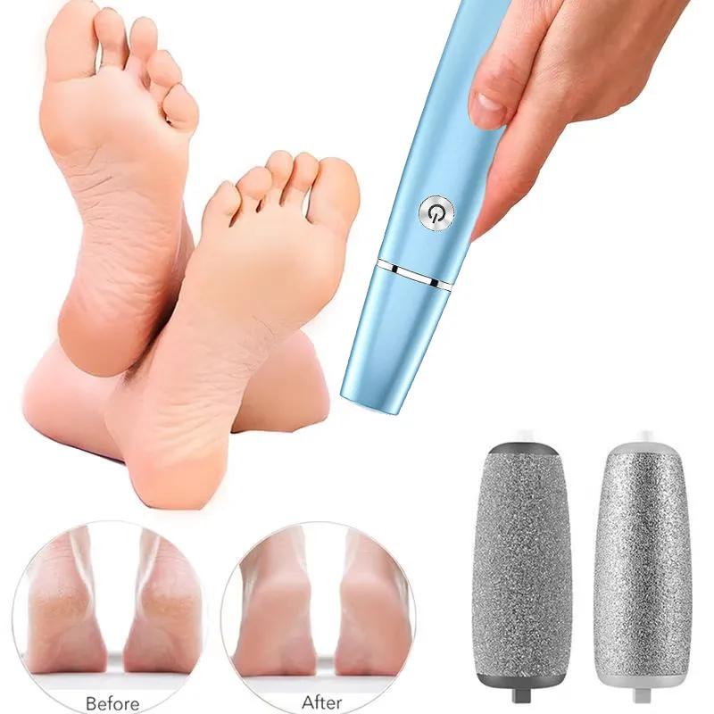 Hot Sale - 50% OFFElectric Feet Callus Remover