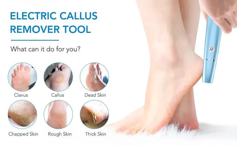 Hot Sale - 50% OFFElectric Feet Callus Remover