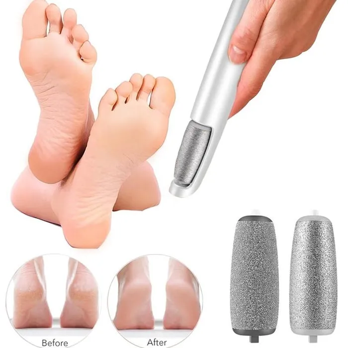 Hot Sale - 50% OFFElectric Feet Callus Remover